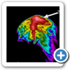 Muscle inflammation over the
gluteals in a horse with trauma